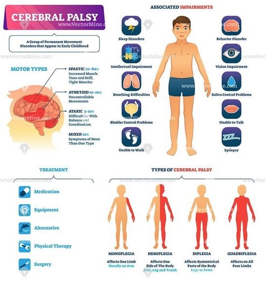 cerebral palsy