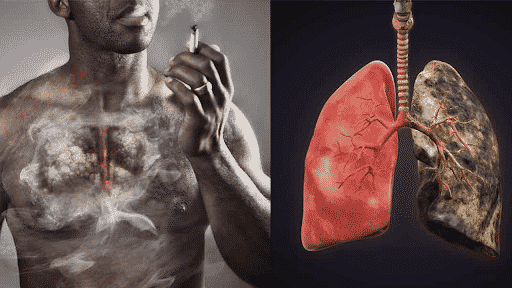 health condition tobacco diseases